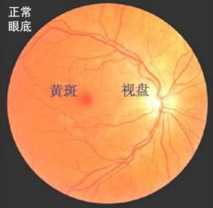 玩手游眼花_玩游戏眼花缭乱_手机打游戏眼花